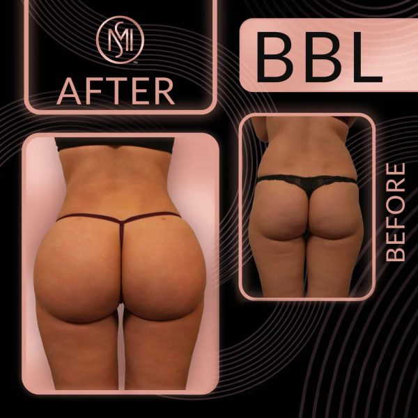 before-after-9
